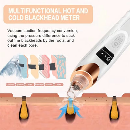 Electric Pore Cleaner & Blackhead Remover – Deep Cleansing Facial Vacuum Tool